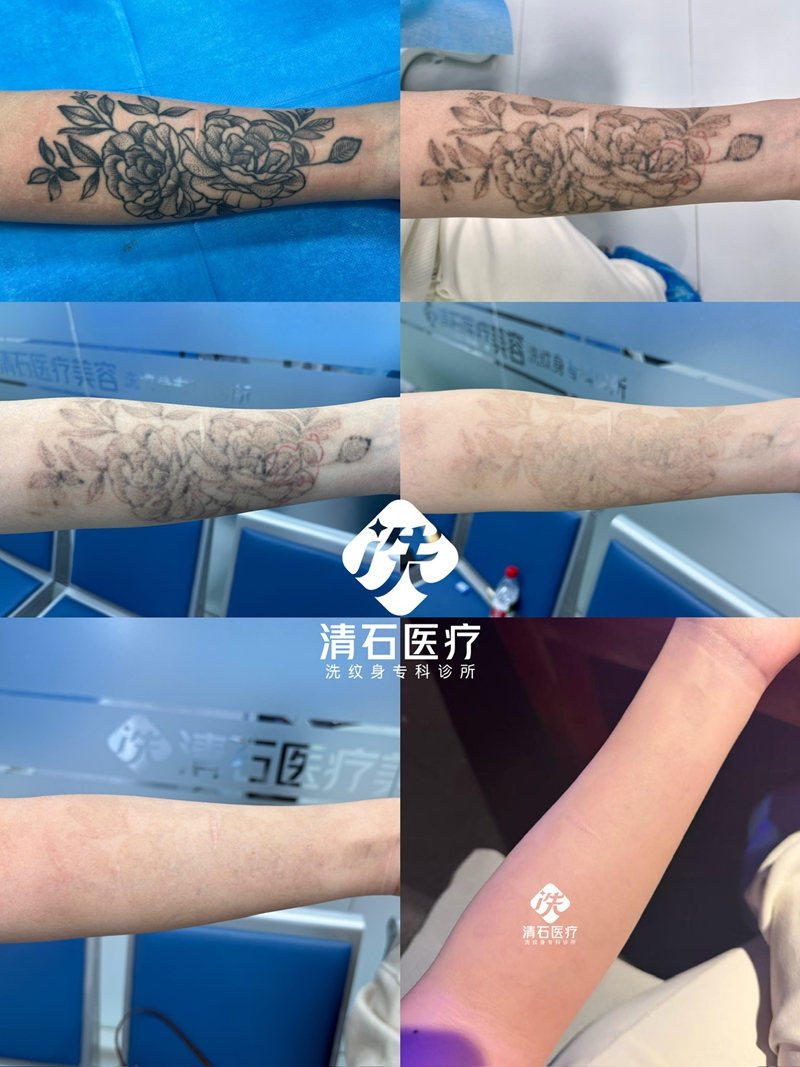 真实案例